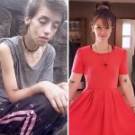تصاویری از زیباترین قبل و بعدهای دنیا